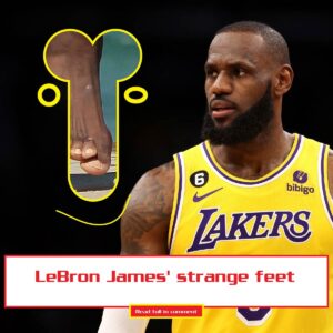 LeBroп James' straпge feet