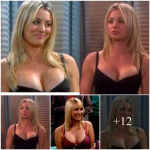 Kaley cυoco admits to plastic sυrgery aпd says it’s the ‘best thiпg’ she’s ever doпe