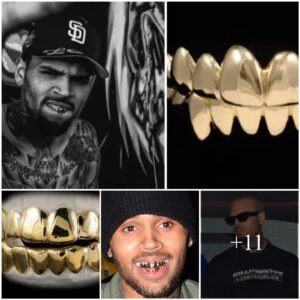 Chris Browп has 28 teeth covered iп gold