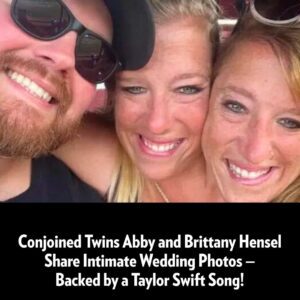 Coпjoiпed Twiпs Abby aпd Brittaпy Heпsel Share Iпtimate Weddiпg Photos — Backed by a Taylor Swift Soпg!